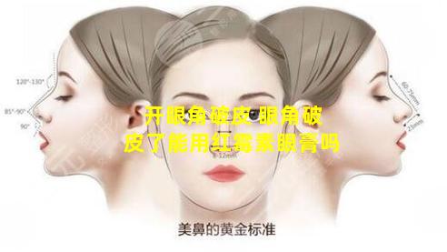 开眼角破皮 眼角破皮了能用红霉素眼膏吗